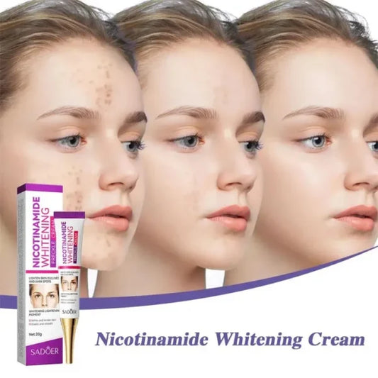 Nicotinamide Whitening Freckles Cream Remove Melasma Dark Spot Acne Marks Lightening Melanin Brightens Skin Tone Face Skin Care